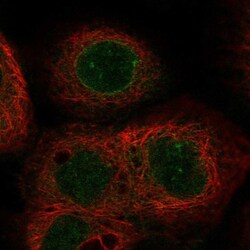 ABHD18 Antibody, Novus Biologicals:Antibodies:Primary Antibodies